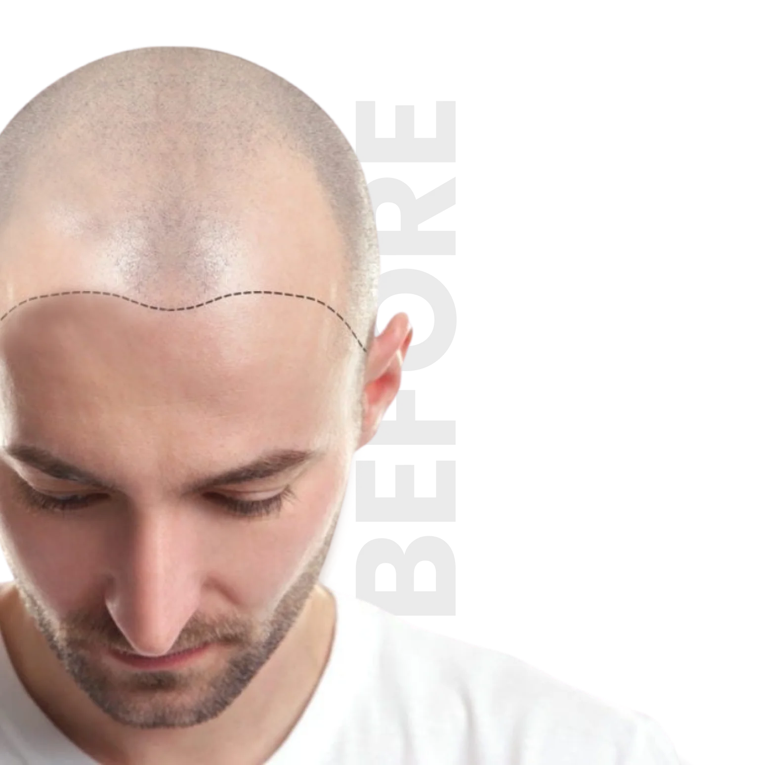 before hair