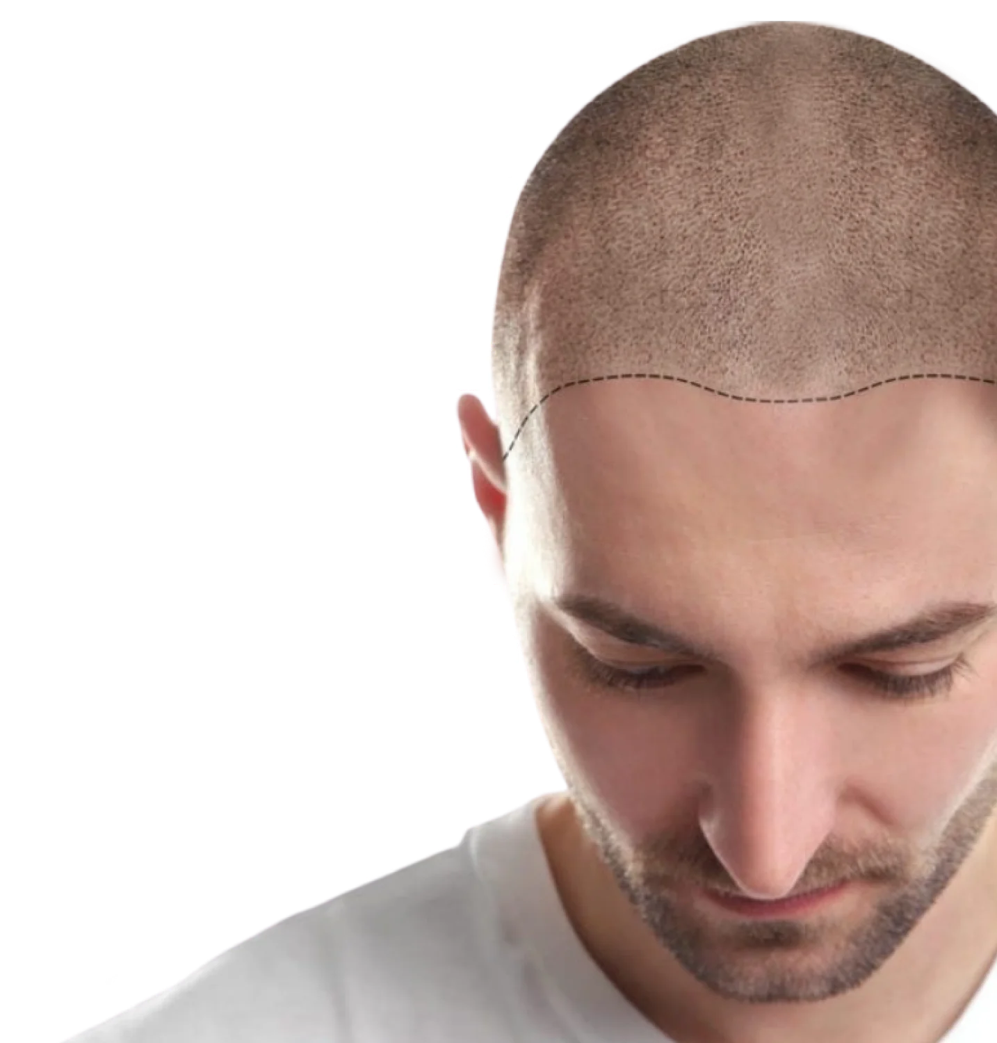 after hair