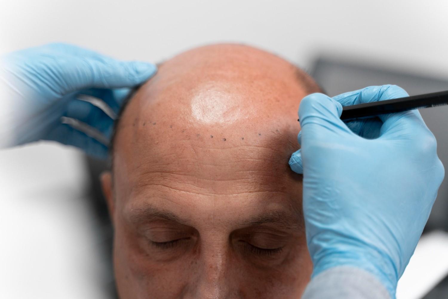 repair pluggy hairline