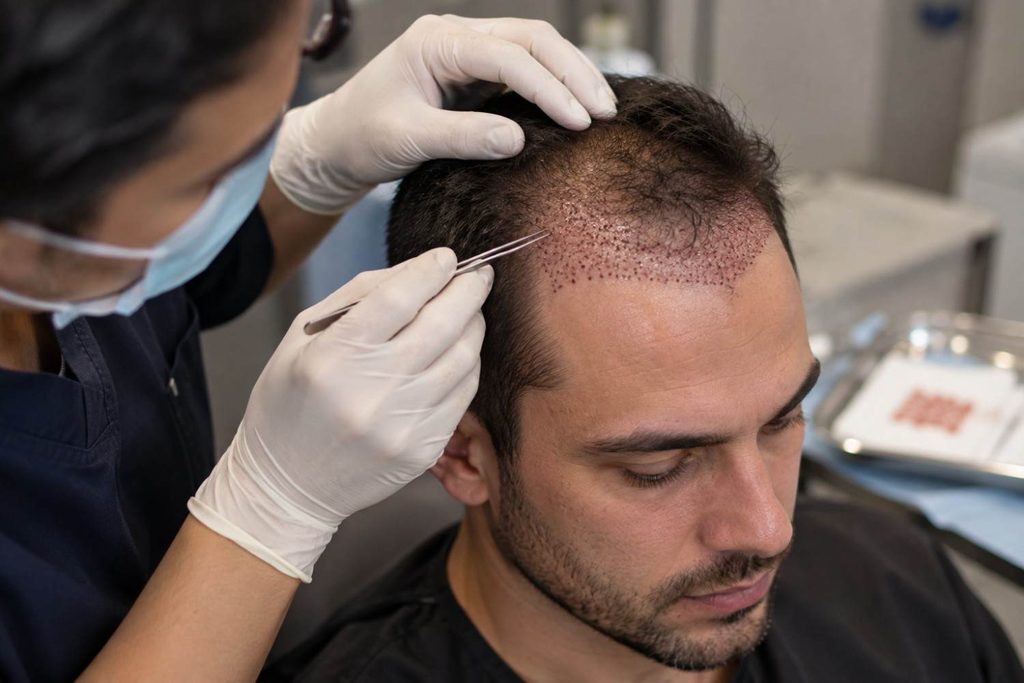 realistic hair density per session